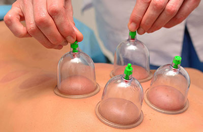 Umesh Bansal Physiotherapy services cupping